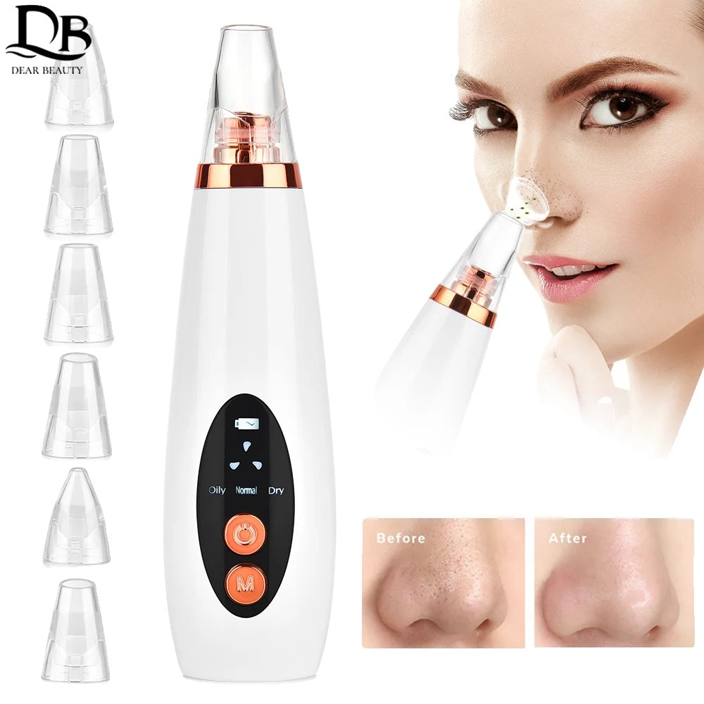 Pore Cleanser, Vacuum Suction, Acne Removal