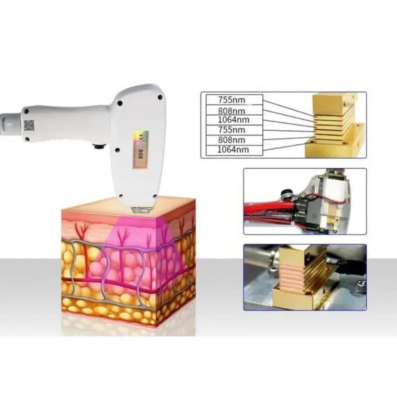 Diodenlaser-Haarentfernungsgerät, professionelle Qualität, Eiskühlung