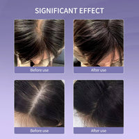 Haarwachstumskamm, Infrarot-Laserbehandlung, Anti-Haarausfall